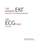150 випадків ЕКГ=150 ECG Cases: пер. 5-го англ. вид.: Навч. посіб.. Изображение №4