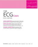 150 випадків ЕКГ=150 ECG Cases: пер. 5-го англ. вид.: Навч. посіб.. Изображение №5