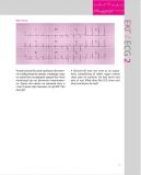 150 випадків ЕКГ=150 ECG Cases: пер. 5-го англ. вид.: Навч. посіб.. Изображение №20